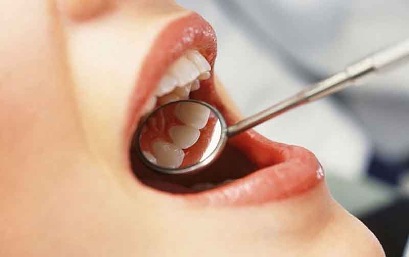 Đối tượng nguy cơ bệnh Nha chu
