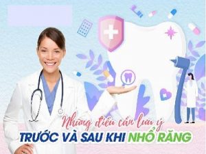lưu ý khi nhổ răng min