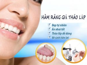 rang ham thao lap min