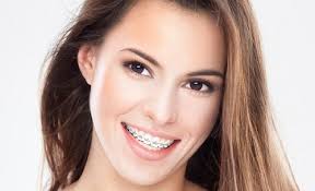 Niềng răng có ảnh hưởng đến tướng số