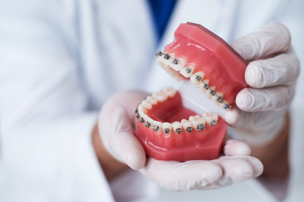 Niềng răng có ảnh hưởng đến sức khỏe không
