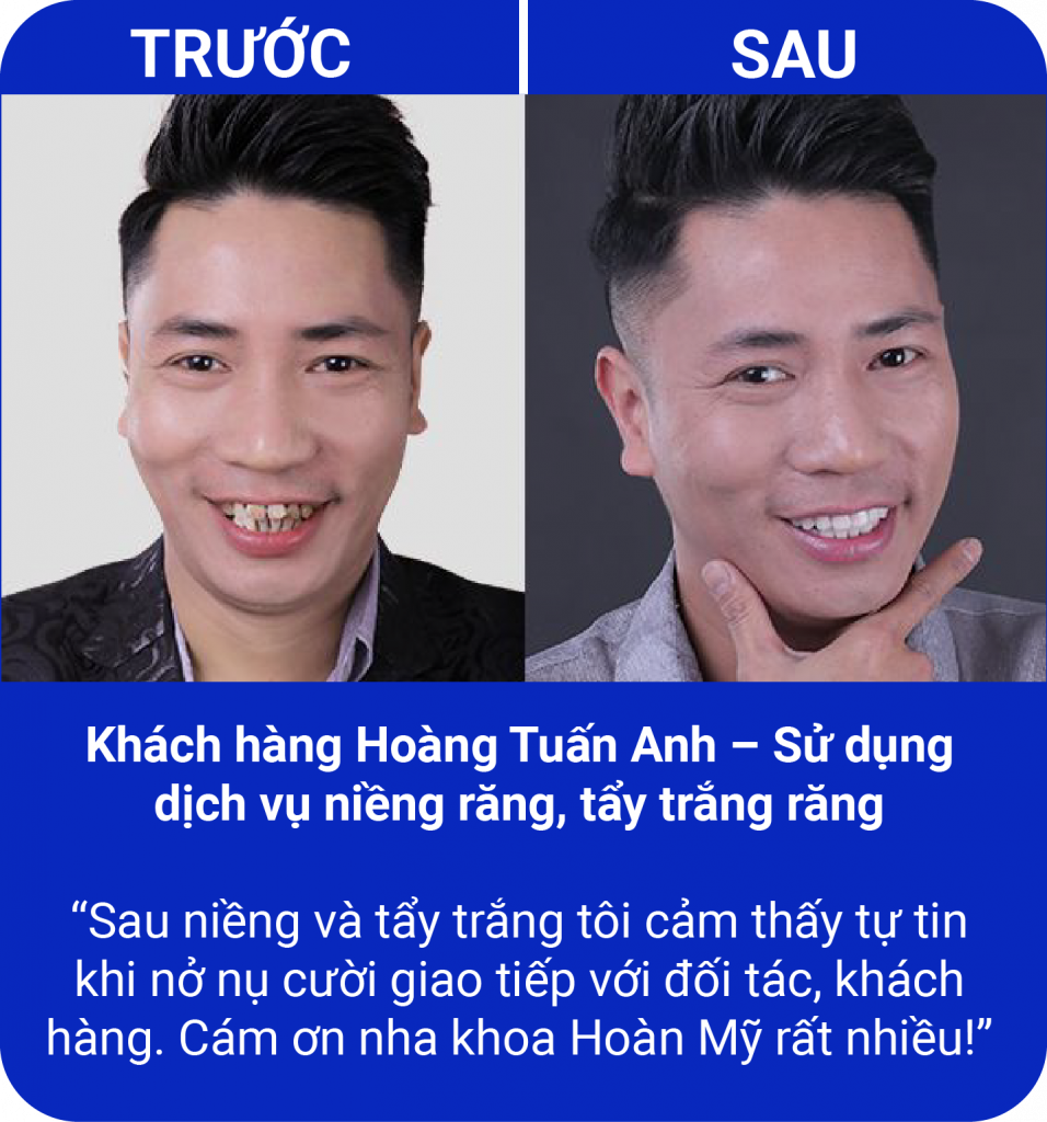 Đồng hành cùng nụ cười của quý khách hàng