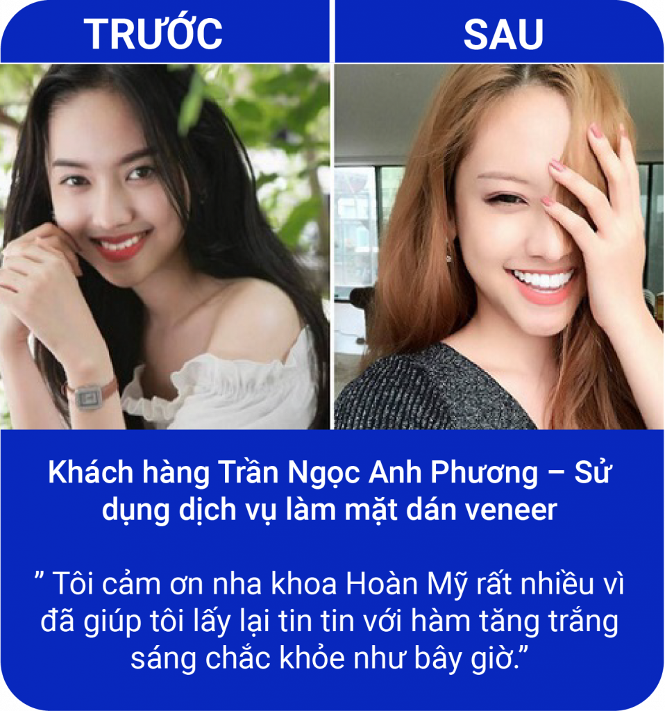 Đồng hành cùng nụ cười của quý khách hàng