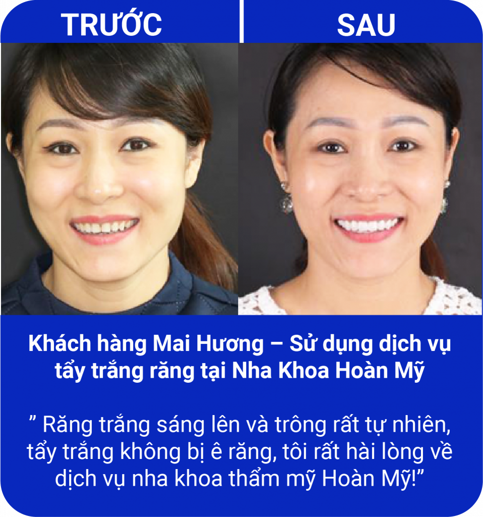 Đồng hành cùng nụ cười của quý khách hàng