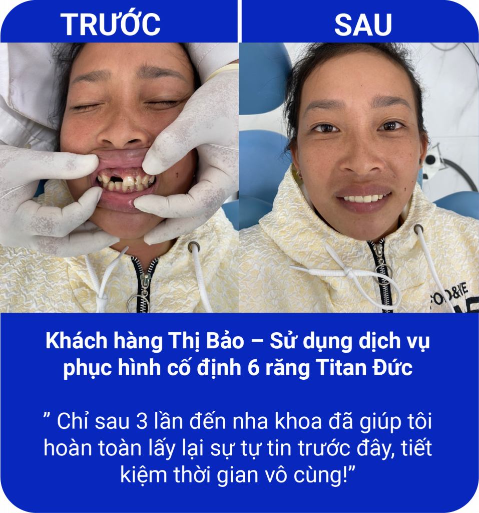 Đồng hành cùng nụ cười của quý khách hàng