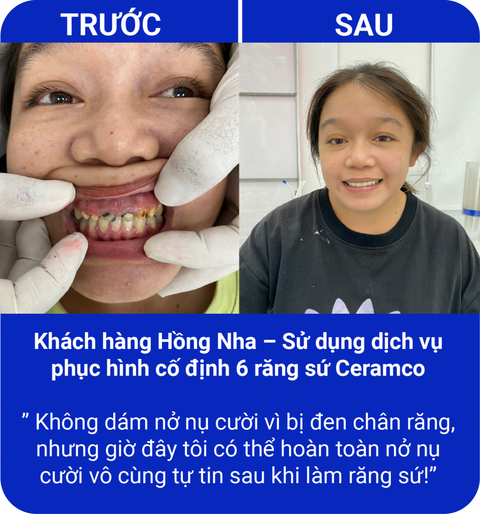 Đồng hành cùng nụ cười của quý khách hàng