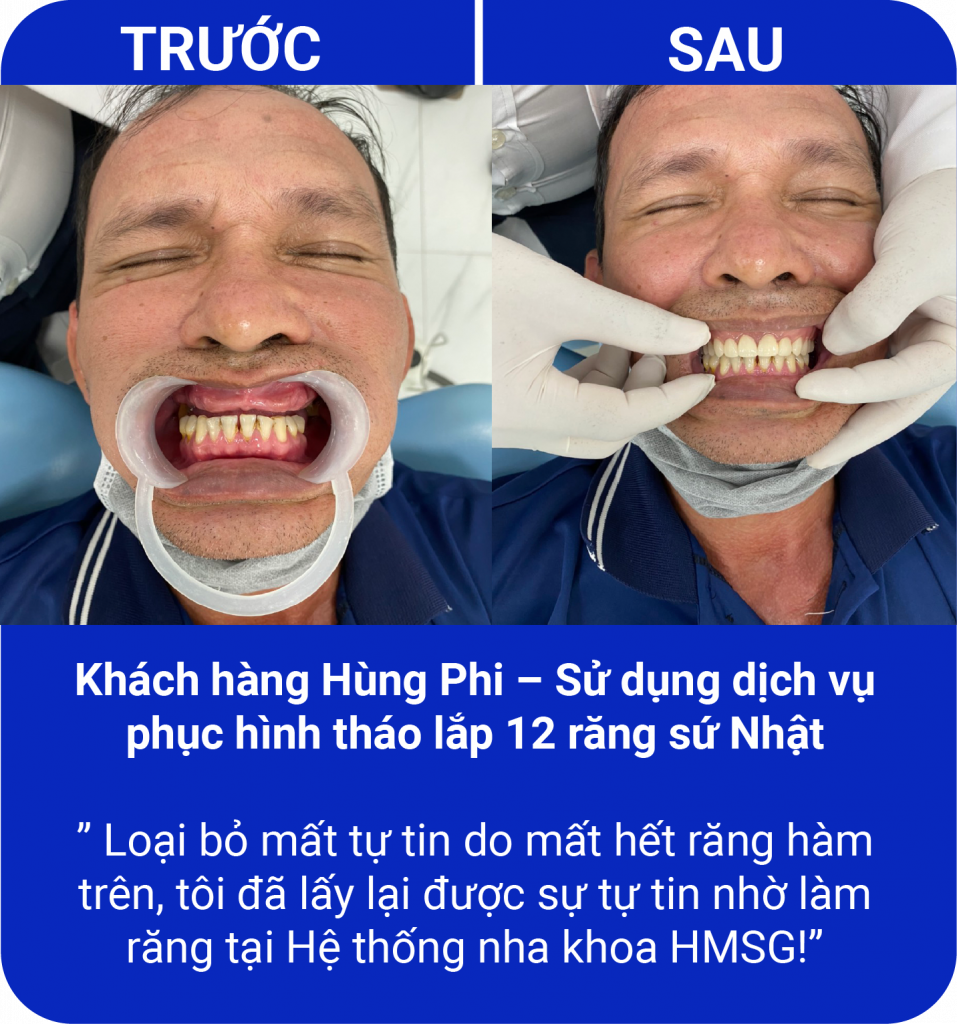 Đồng hành cùng nụ cười của quý khách hàng