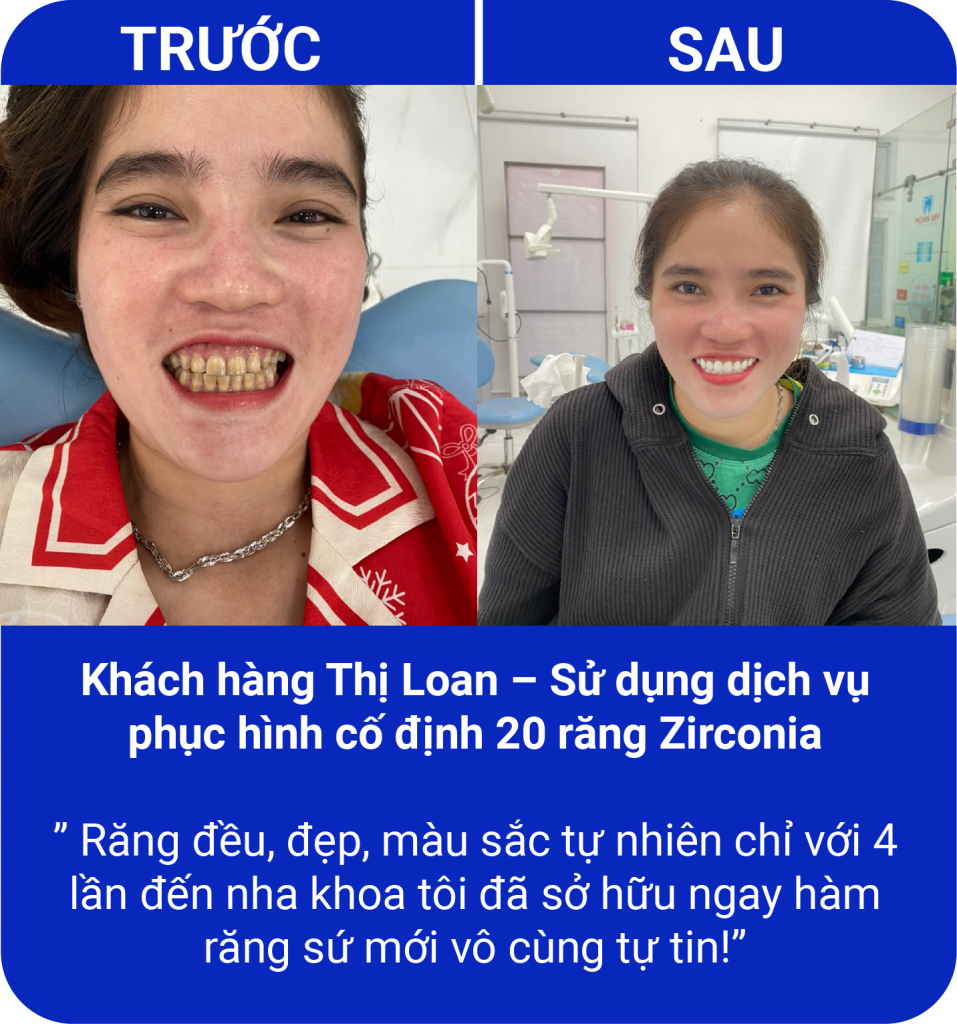 Đồng hành cùng nụ cười của quý khách hàng