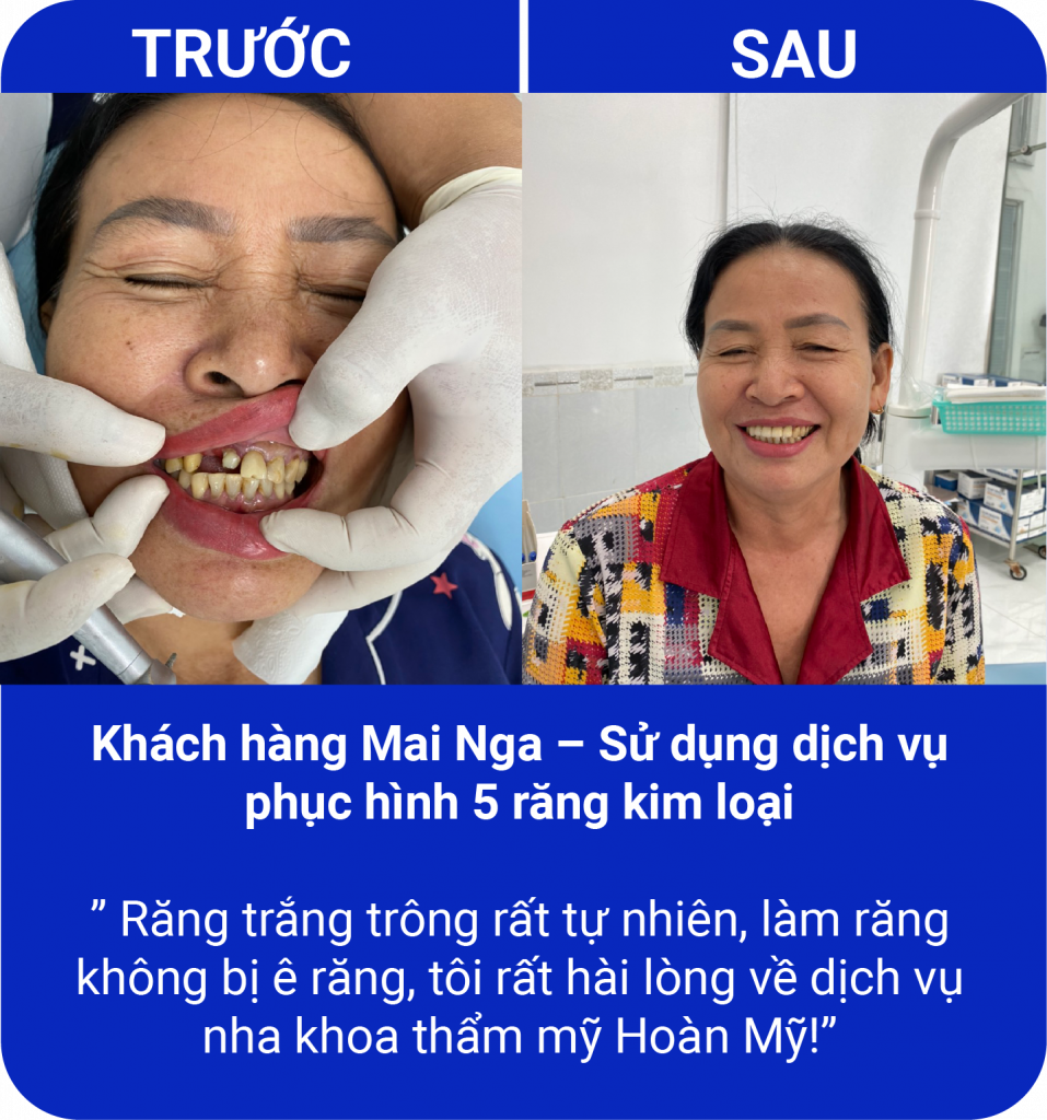 Đồng hành cùng nụ cười của quý khách hàng