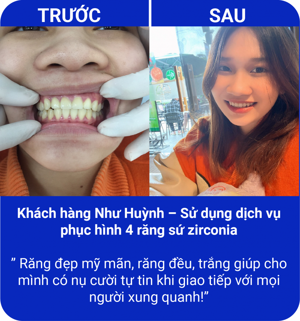 Đồng hành cùng nụ cười của quý khách hàng