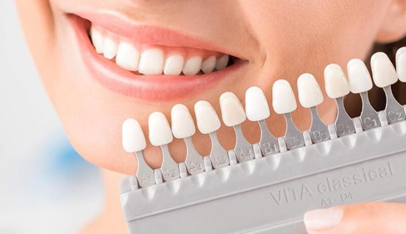 Bảng màu răng sứ Cercon