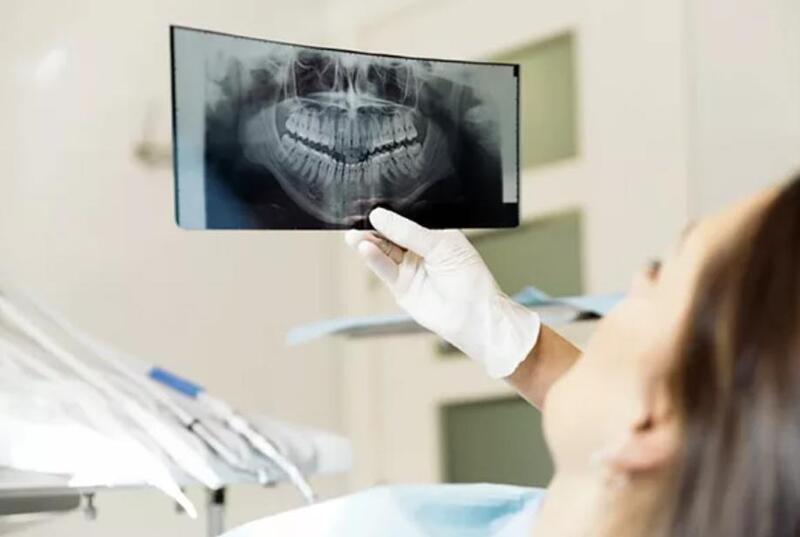 Chụp X-quang để biết chính xác và chi tiết tình trạng răng