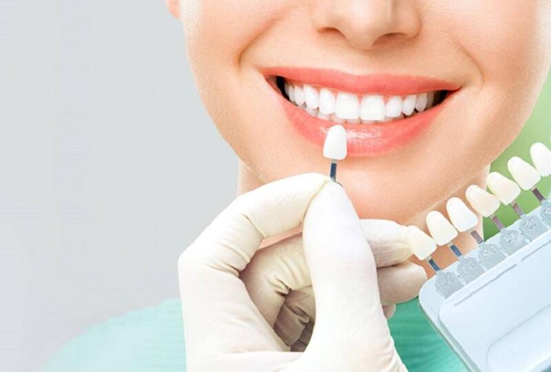 Dán sứ Emax mang lại nhiều lợi ích, đặc biệt giúp bạn tự tin tỏa sáng