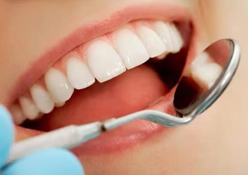 Răng sứ Cercon HT có độ cứng vượt trội