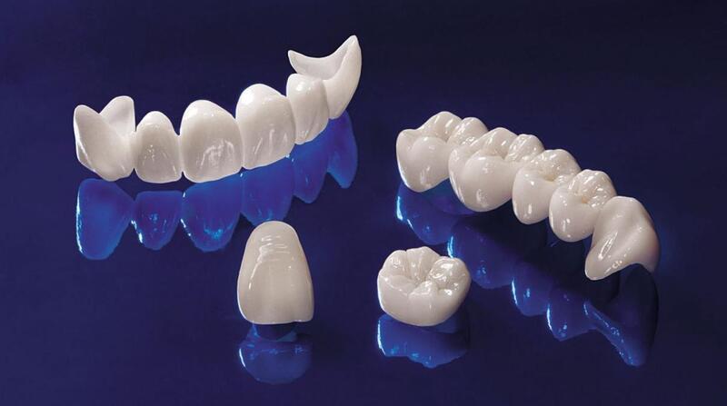 Răng sứ Cercon là loại răng sứ cao cấp có xuất xứ từ Đức