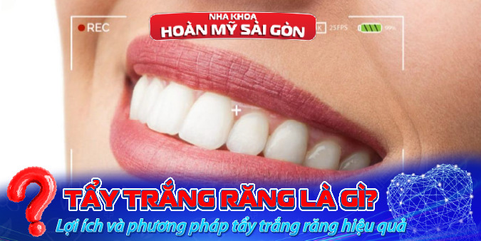 tẩy trắng răng