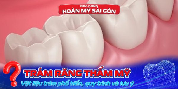 Trám răng thẩm mỹ
