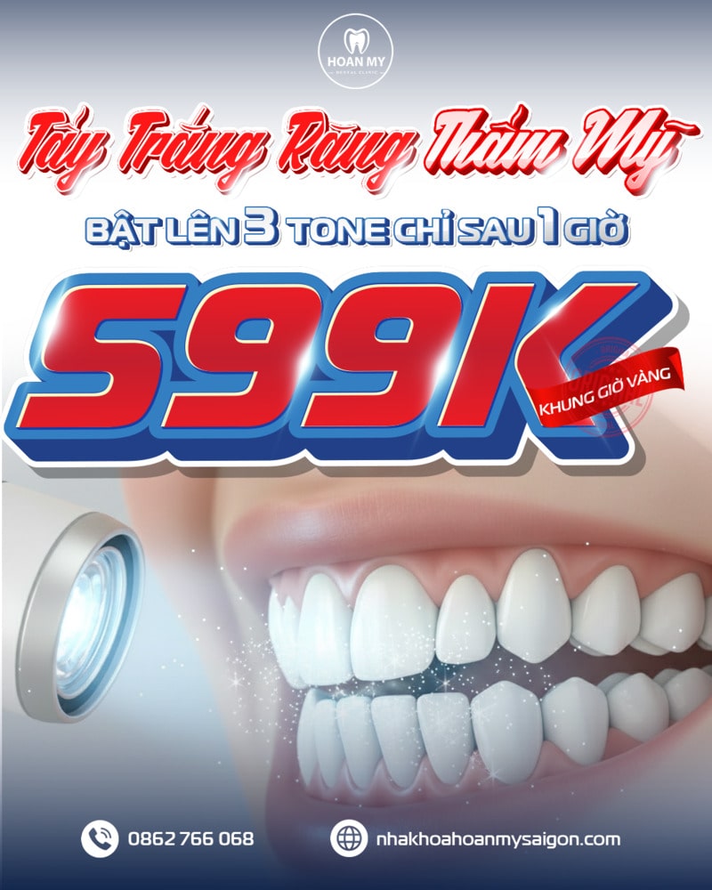 TAY TRANG RANG HOAN MY min