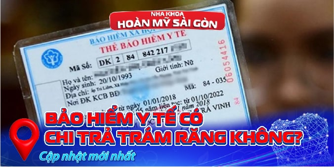 Bảo hiểm y tế có chi trả trám răng không