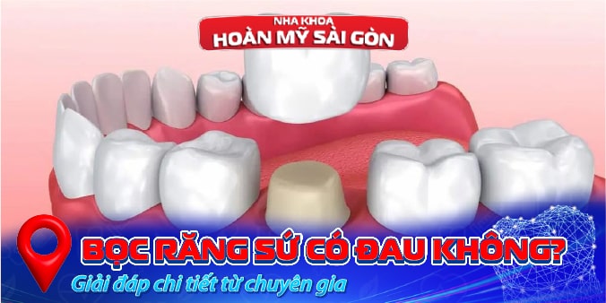 Bọc răng sứ có đau không