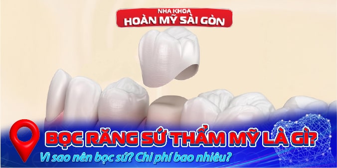 bọc răng sứ thẩm mỷ