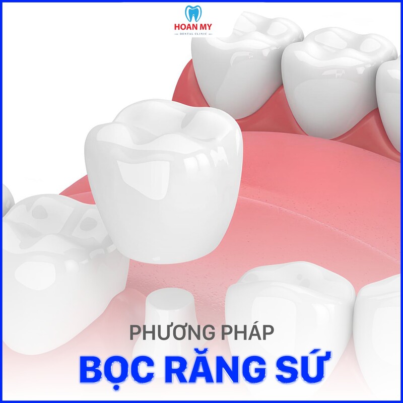 bọc răng sứ thẩm mỹ