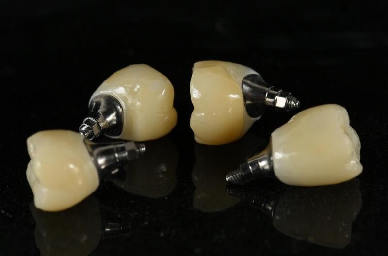 Răng toàn sứ đảm bảo tính thẩm mỹ cao hơn