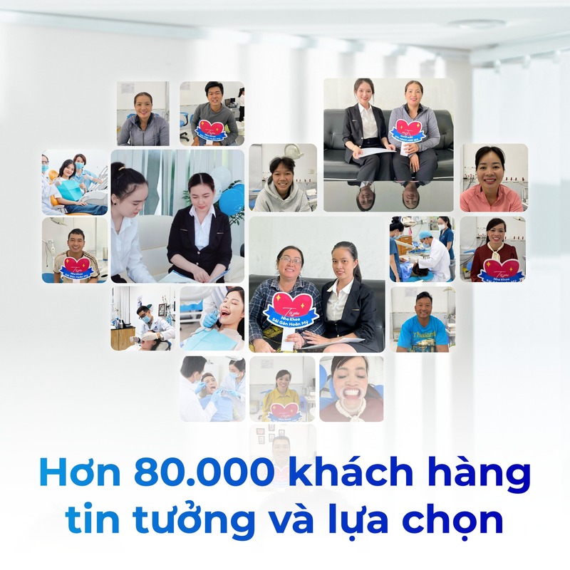 hình ảnh khách hàng bọc sứ thẩm mỹ tại Hoàn Mỹ Sài Gòn