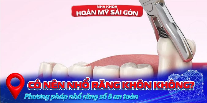 nhổ răng khôn