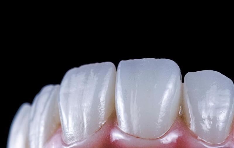 Răng sứ Cercon HT màu trắng đục