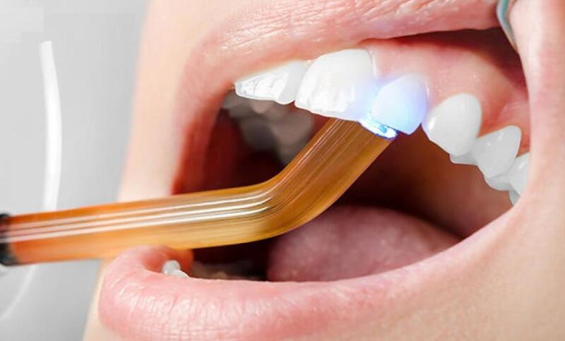 Sau khi trám răng cửa sẽ dùng đèn Halogen để làm đông lớp trám