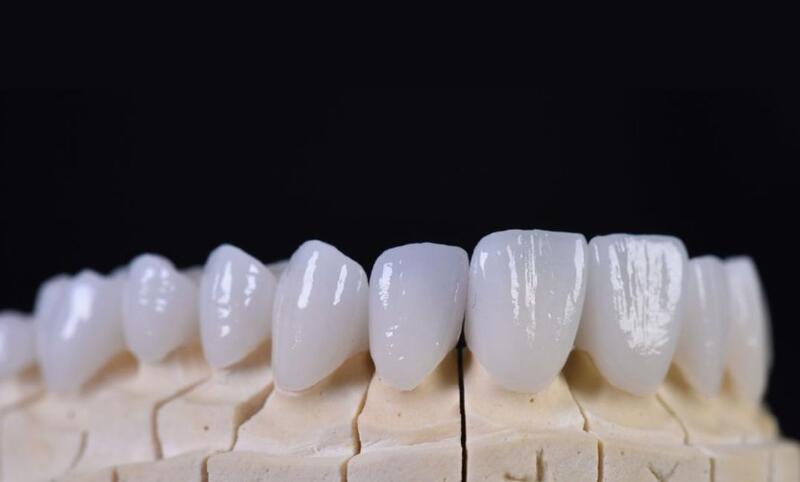 Răng sứ ddbio phù hợp với những ai