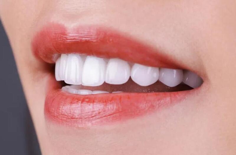 Răng sứ Đức được đánh giá cao với nhiều ưu điểm vượt trội