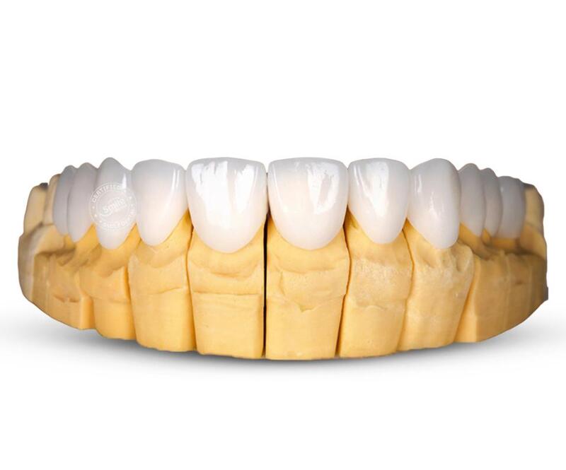 răng sứ hàn quốc