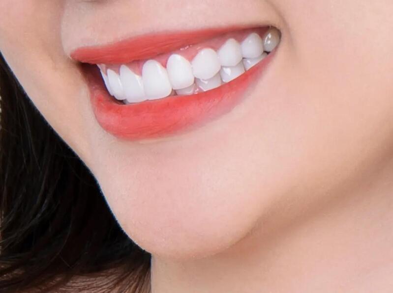 Răng sứ của hàn quốc có tốt không