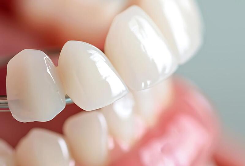 Răng sứ Zirconia có màu sắc trắng sáng tự nhiên