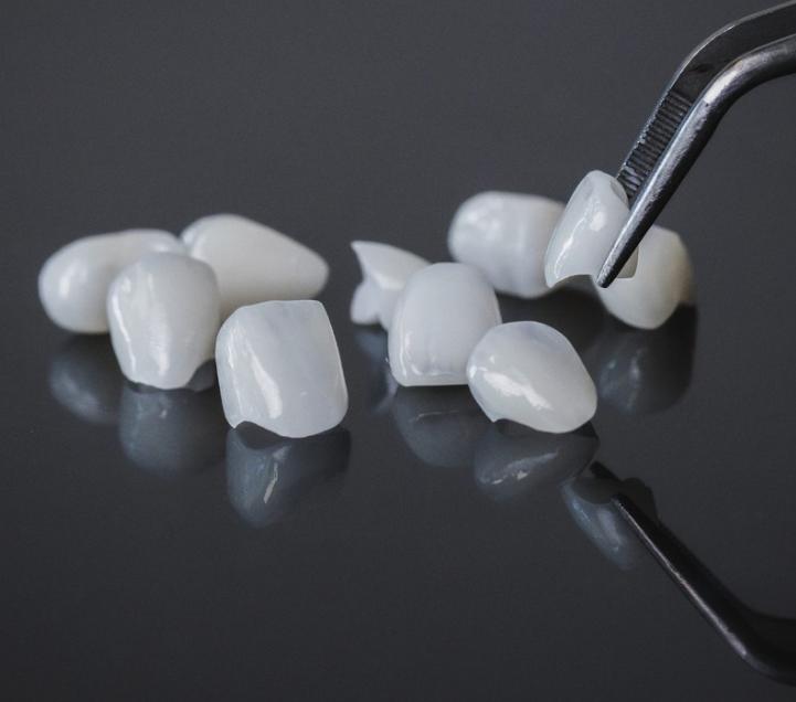 Răng toàn sứ là dòng răng sứ Mỹ cao cấp nhất