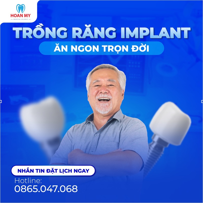 ưu điểm của việc trồng răng implant