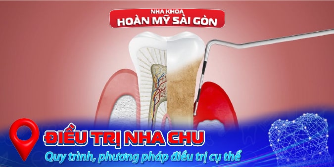 Điều trị nha chu