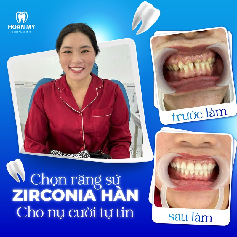 khach hang tai nha khoa hoan my sai gon